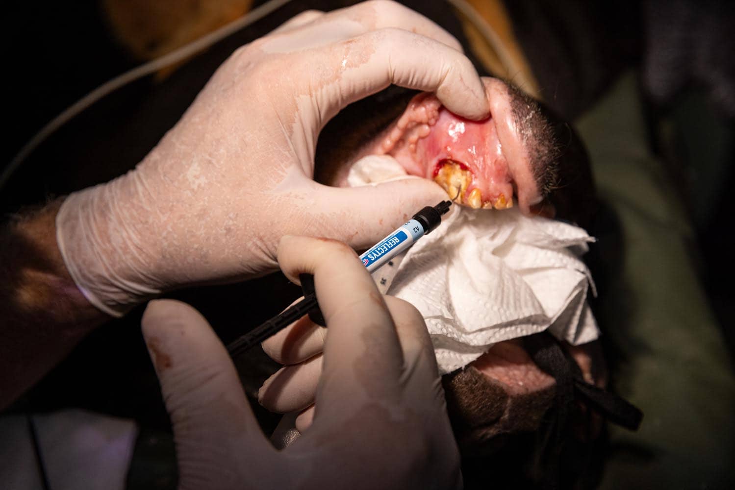Document_Photography_Videography_Vietnam_Animal_Asia_Itena_Clinical_DrCedric_Tutt_Bear_Rescue_BinhDang_photographer_Hanoi_HoChiMinh_Asia_029_
